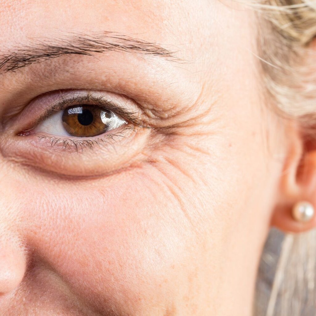 fine lines wrinkles eyes woman close up