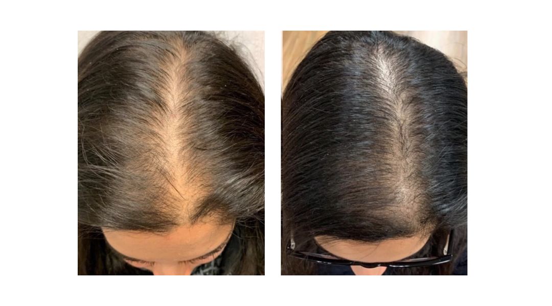 KeraFactor Serum before and after results