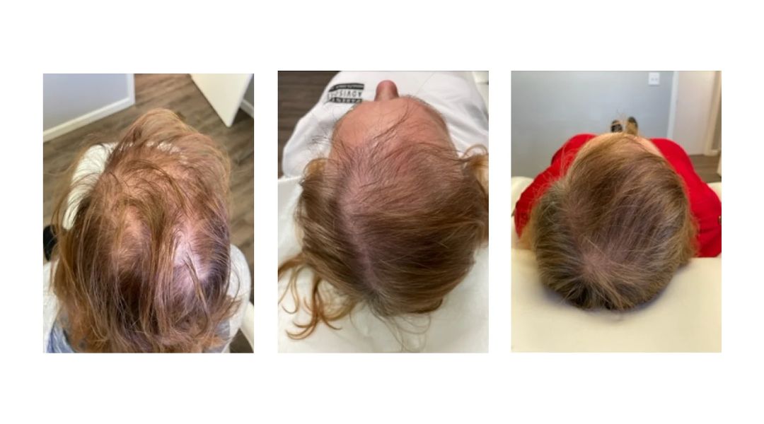 KeraFactor Serum before and after results