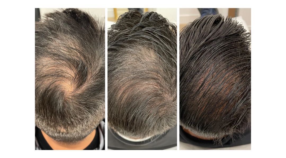 KeraFactor Serum before and after results