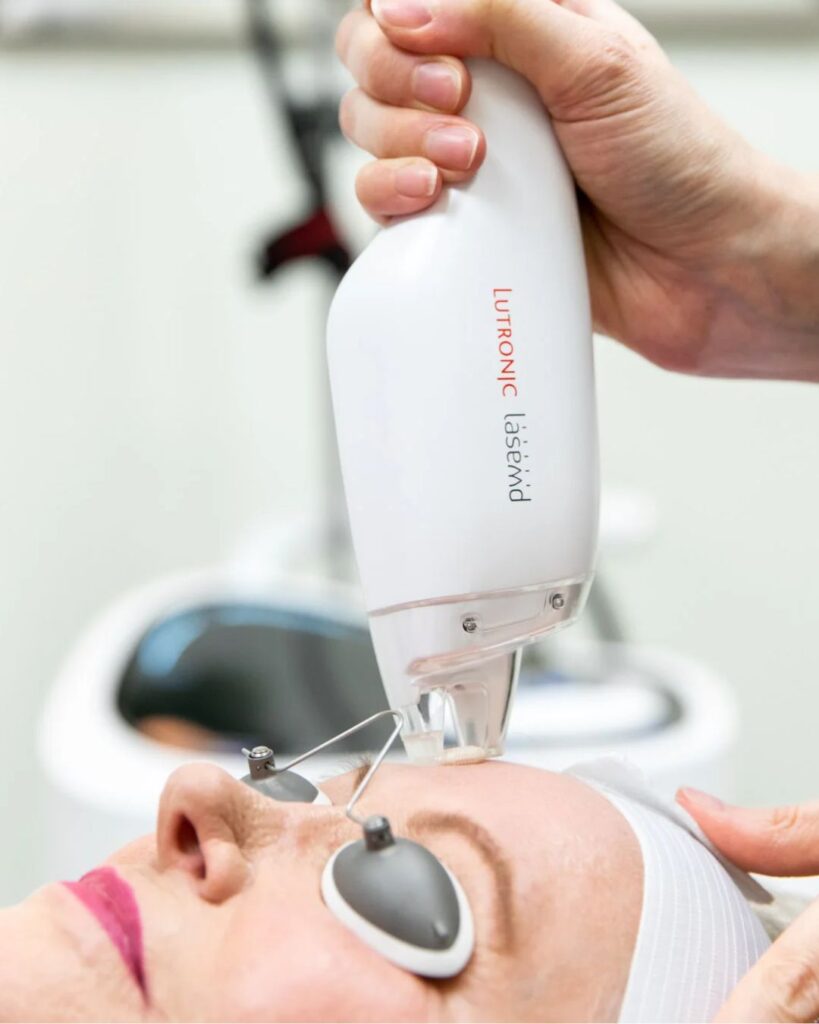 LaseMD skin rejuvenation treatment