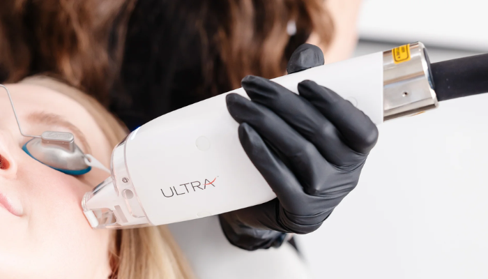 laser skin rejuvenation san diego