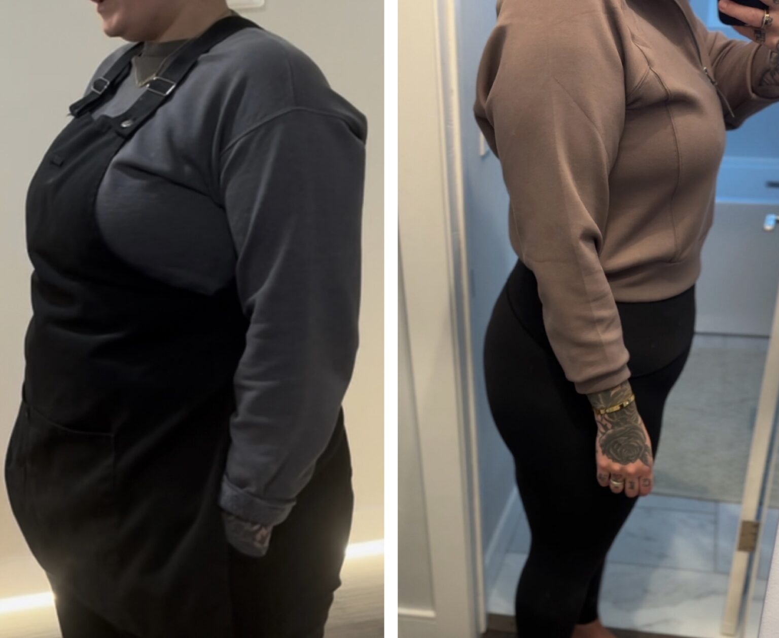 before and after weight loss 1