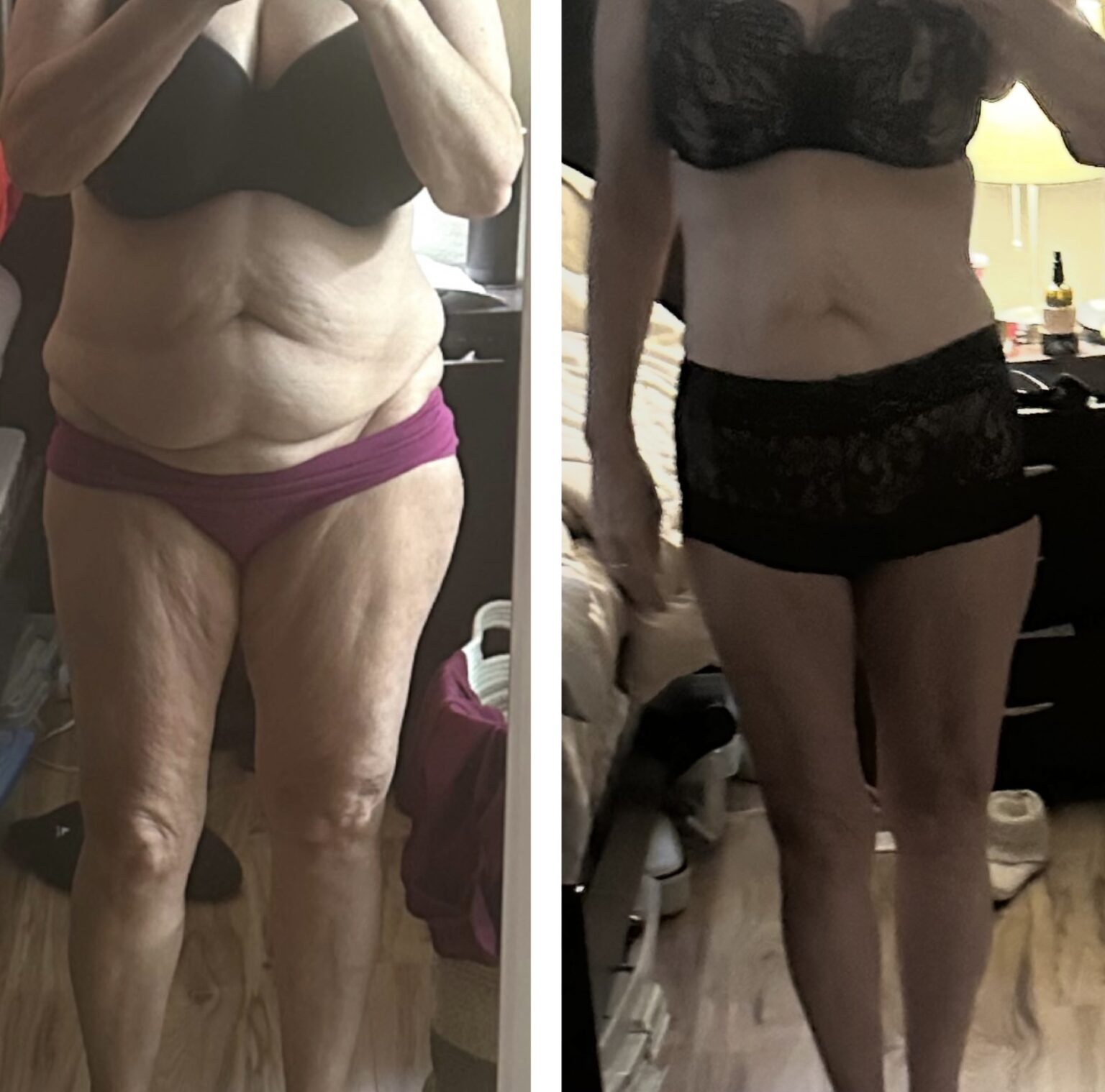 before and after weight loss 3