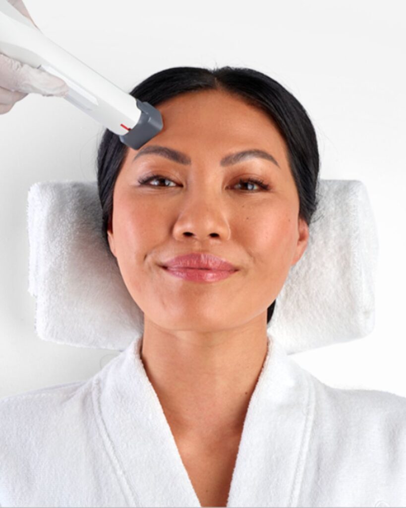 Xerf skin tightening